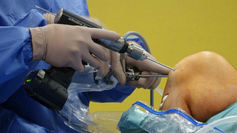 Orthopedic surgeon using equipment during knee arthroscopy in the operating room.