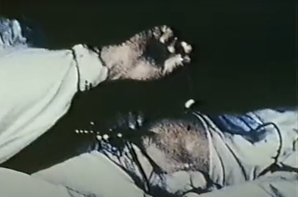 Historical still from Watanabe's arthroscopic meniscectomy