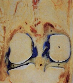 Coronal knee anatomy used to orient MRI interpretation