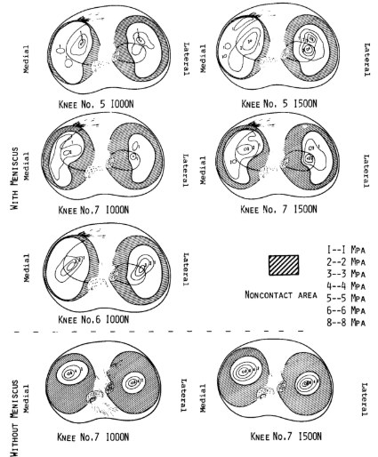 Contact pressure diagrams with and without the meniscus