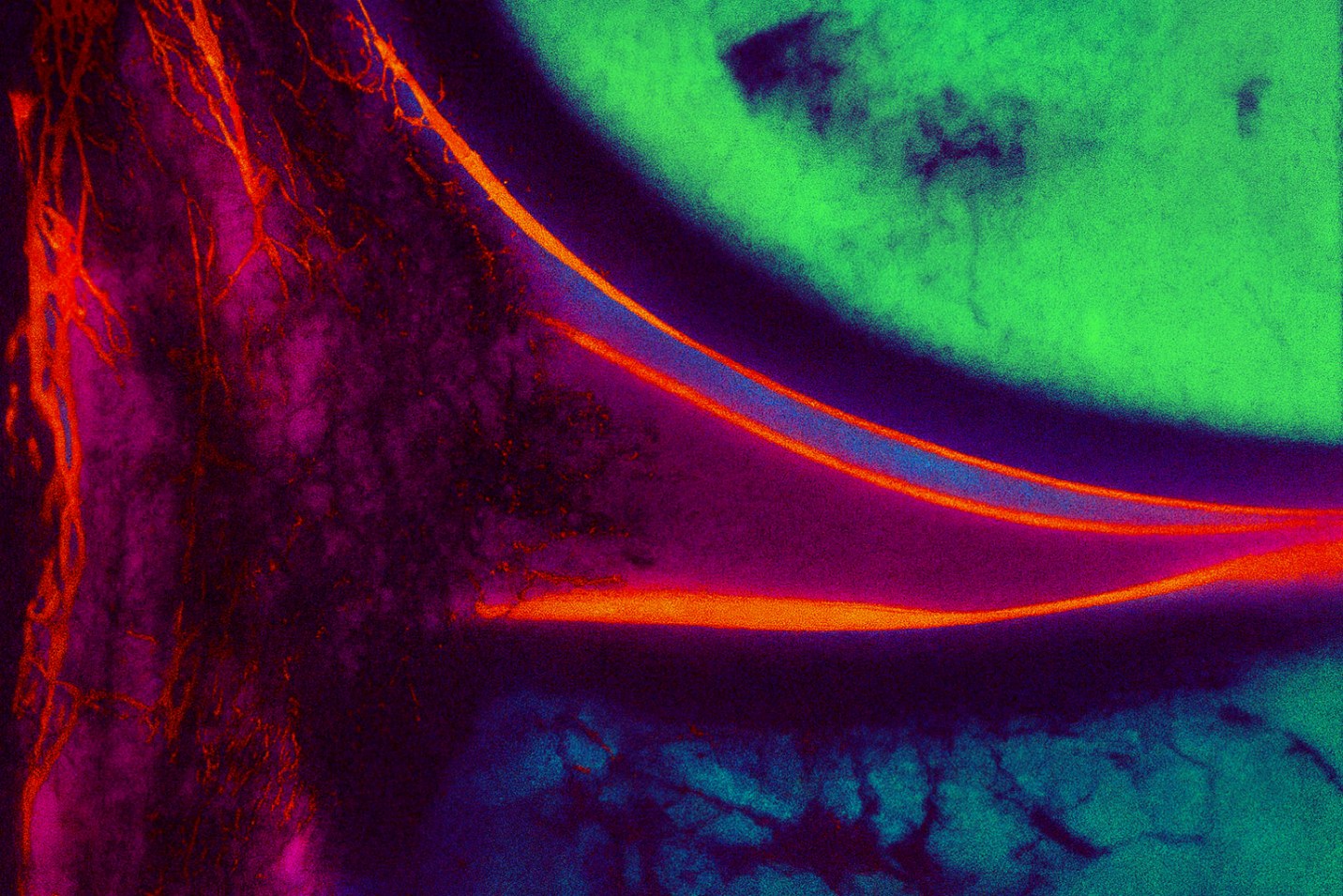 Microvascular image of the peripheral meniscus